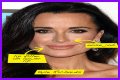 Botox, Implants & More! – Hollywood Life